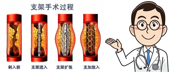 initpintu_副本.jpg