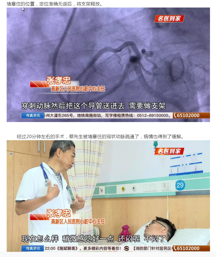 救治心梗患者，苏州广电社会传真，20190623.png