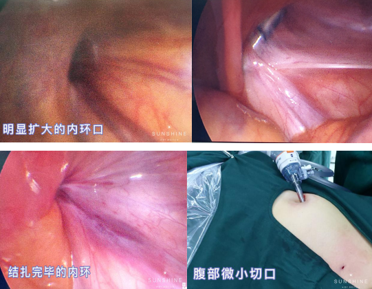 微信截图_20200729103520.png